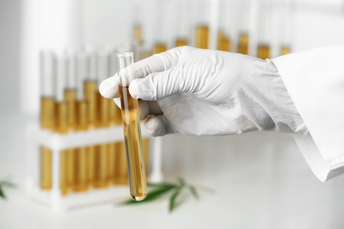 Concerns over ‘ethically unacceptable’ CBD testing proposed by FSA